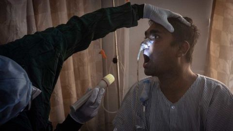 Hongo negro: 6 claves de la rara infección que ataca a pacientes con covid19