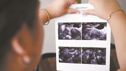 Corte avala que personal de salud podrá negarse a realizar un aborto