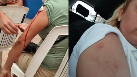 'Me sangró mucho el brazo': Surgen quejas por mala aplicación de vacuna