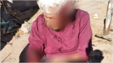 Mujer de la tercera edad es atacada brutalmente por jauría de perros en Mexicali