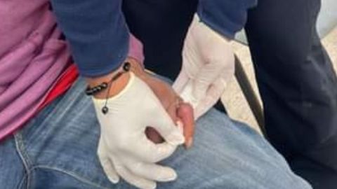 Bomberos cortan anillo en dedo ya hinchado y se vuelve viral