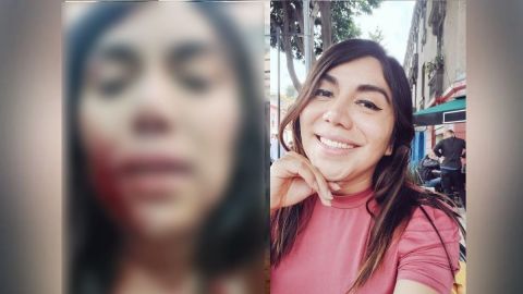 🎥 ''Estoy sangrando mucho'': Acuchillan a Natalia Lane, activista transexual