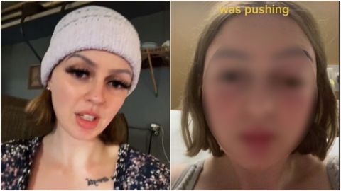 A mujer embarazada se le 'sale' el ojo durante el parto