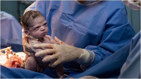 Bebé que 'nació enojada' se reencuentra con fotográfo que la hizo viral