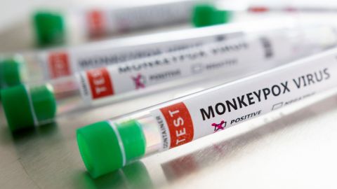 Reportan tres casos sospechosos de viruela del mono en San Diego