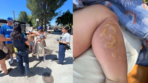 Bebé tijuanense sufre quemadura en Six Flags y parque se niega a brindar ayuda