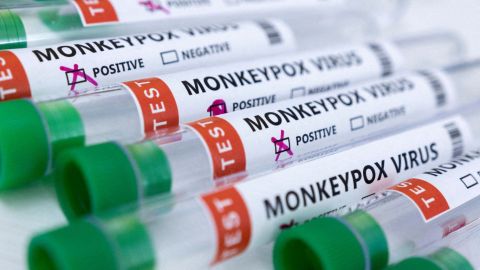 Homosexuales y profesionales del sexo deben vacunarse contra viruela del mono