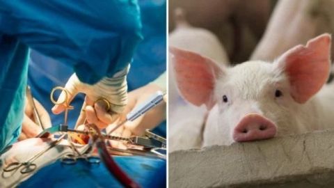 Trasplantan con éxito dos corazones de cerdo en receptores con muerte cerebral