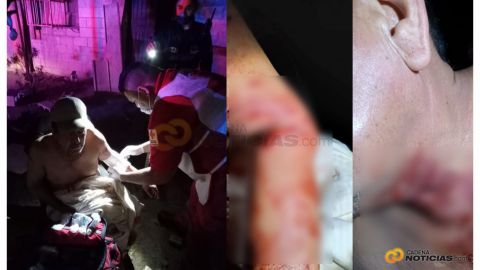 Adulto mayor pierde dedo por ataque perro en Mexicali