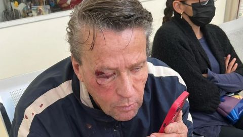 Alfredo Adame fue brutalmente golpeado por unos ''malandros''