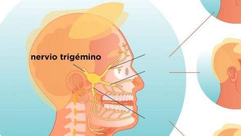 Día Internacional de la Neuralgia Trigeminal