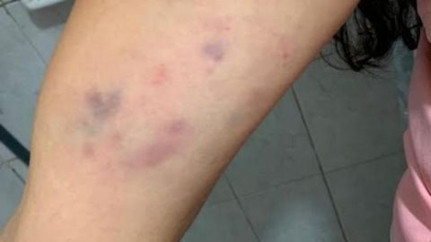 Policías detienen y golpean a pareja en pleno Cervantino