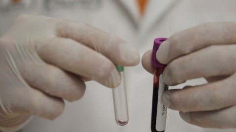 Día Mundial de lucha contra el VIH: Cómo afecta el SIDA el sistema inmunológico