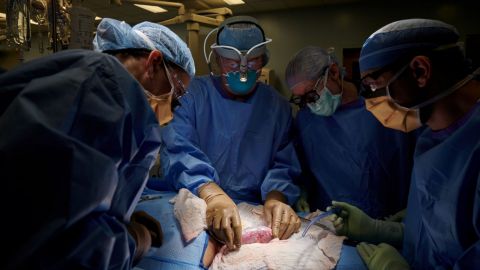 Trasplantan riñón de cerdo a un cuerpo humano en Nueva York