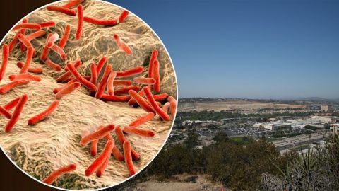 Reportan caso activo de tuberculosis en Mission Valley