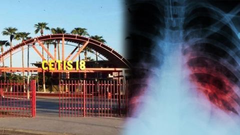 Encuentran casos de tuberculosis en plantel educativo de Mexicali