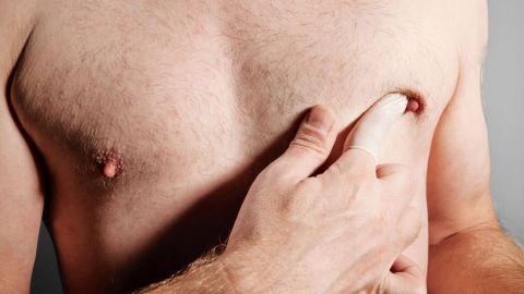 Pro Oncavi lanza campaña para prevenir el cáncer de mama en hombres