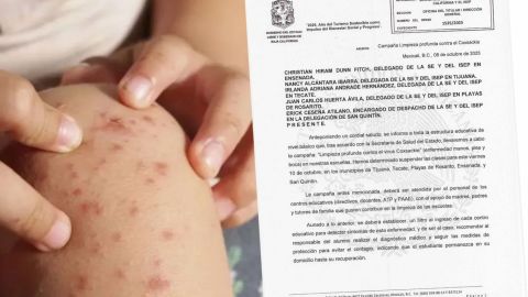 Suspenden clases en Baja California debido al brote del virus Coxsackie