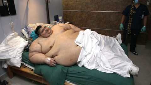 Muere Juan Pedro Franco, mexicano que rompió récord Guinness por obesidad