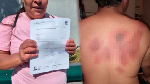 Estudiante sufre quemaduras por agresión con químico en secundaria de Tijuana
