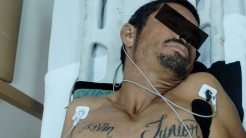 Velador se queda dormido y accidentalmente se dispara con escopeta en la pierna